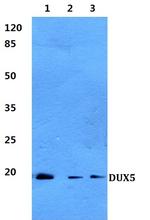 DUX5 Polyclonal Antibody