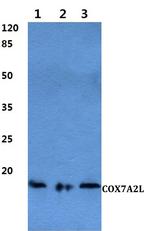COX7A2L Polyclonal Antibody