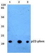 CYBA Polyclonal Antibody