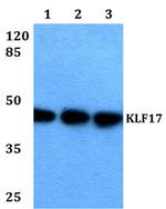 KLF17 Antibody in Western Blot (WB)