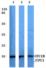 CFC1B/CFC1 Polyclonal Antibody