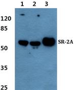 HTR2A Polyclonal Antibody