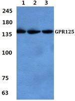 GPR125 Polyclonal Antibody
