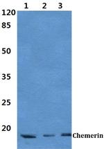 Chemerin Polyclonal Antibody