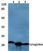 Cytoglobin Polyclonal Antibody