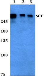 Secretin Polyclonal Antibody