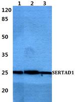 SERTAD1 Polyclonal Antibody