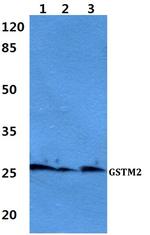 GSTM2 Polyclonal Antibody