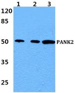 PANK2 Polyclonal Antibody