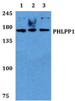 PHLPP1 Polyclonal Antibody
