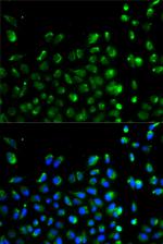 ATG13 Antibody in Immunocytochemistry (ICC/IF)