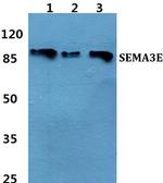 SEMA3E Polyclonal Antibody