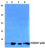 S100A7 Polyclonal Antibody