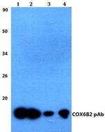 COX6B2 Polyclonal Antibody