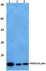FAM215A Polyclonal Antibody