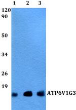 V-ATPase G3 Polyclonal Antibody