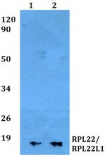 RPL22L1 Polyclonal Antibody