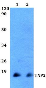 TNP2 Polyclonal Antibody