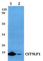 CST9LP1 Polyclonal Antibody