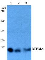 BTF3L4 Polyclonal Antibody