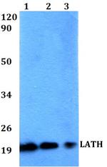 LATH Polyclonal Antibody