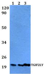 TGIF2LY Polyclonal Antibody