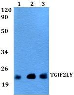 TGIF2LY Polyclonal Antibody