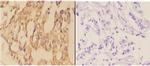 AANAT Polyclonal Antibody