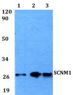 SCNM1 Antibody in Western Blot (WB)