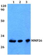 MMP26 Polyclonal Antibody