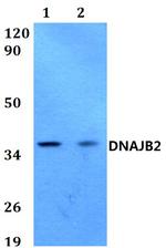 DNAJB2 Polyclonal Antibody