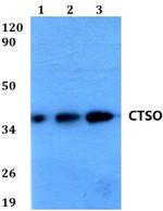 Cathepsin O Polyclonal Antibody