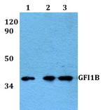 GFI1B Polyclonal Antibody