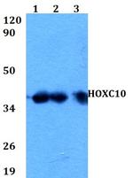 HOXC10 Polyclonal Antibody