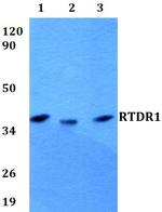 RTDR1 Polyclonal Antibody