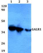 GALR1 Polyclonal Antibody