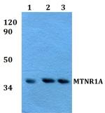 MTNR1A Polyclonal Antibody