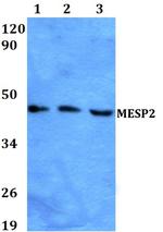MESP2 Polyclonal Antibody