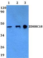 ZDHHC18 Polyclonal Antibody