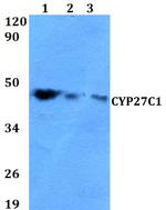 CYP27C1 Antibody in Western Blot (WB)