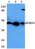 Kir4.2 (KCNJ15) Polyclonal Antibody