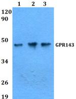 GPR143 Polyclonal Antibody