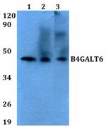 B4GALT6 Polyclonal Antibody