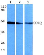 COLQ Polyclonal Antibody