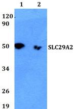 ENT2 Polyclonal Antibody