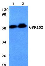 GPR152 Polyclonal Antibody