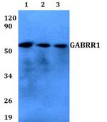 GABRR1 Polyclonal Antibody