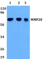 MMP28 Antibody in Western Blot (WB)