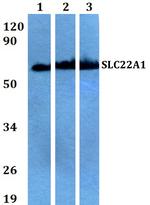 SLC22A1 Polyclonal Antibody