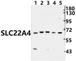 SLC22A4 Polyclonal Antibody